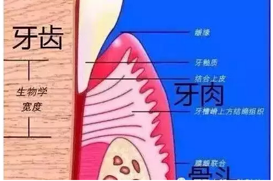 牙龈萎缩背后坑爹的牙槽骨